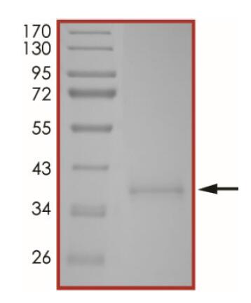 The purity of 2019-nCoV Spike protein S1 subunit, RBD (S477G) was determined to be >90% by densitometry